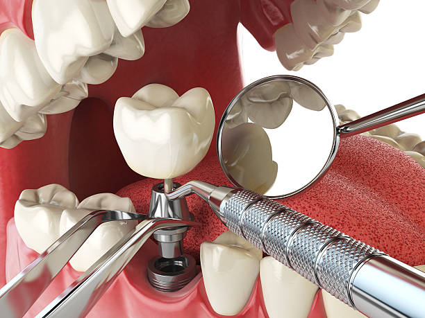 Best Emergency Care for Gum Disease in Auburn, IL